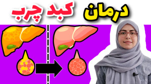 درمان کبد چرب
