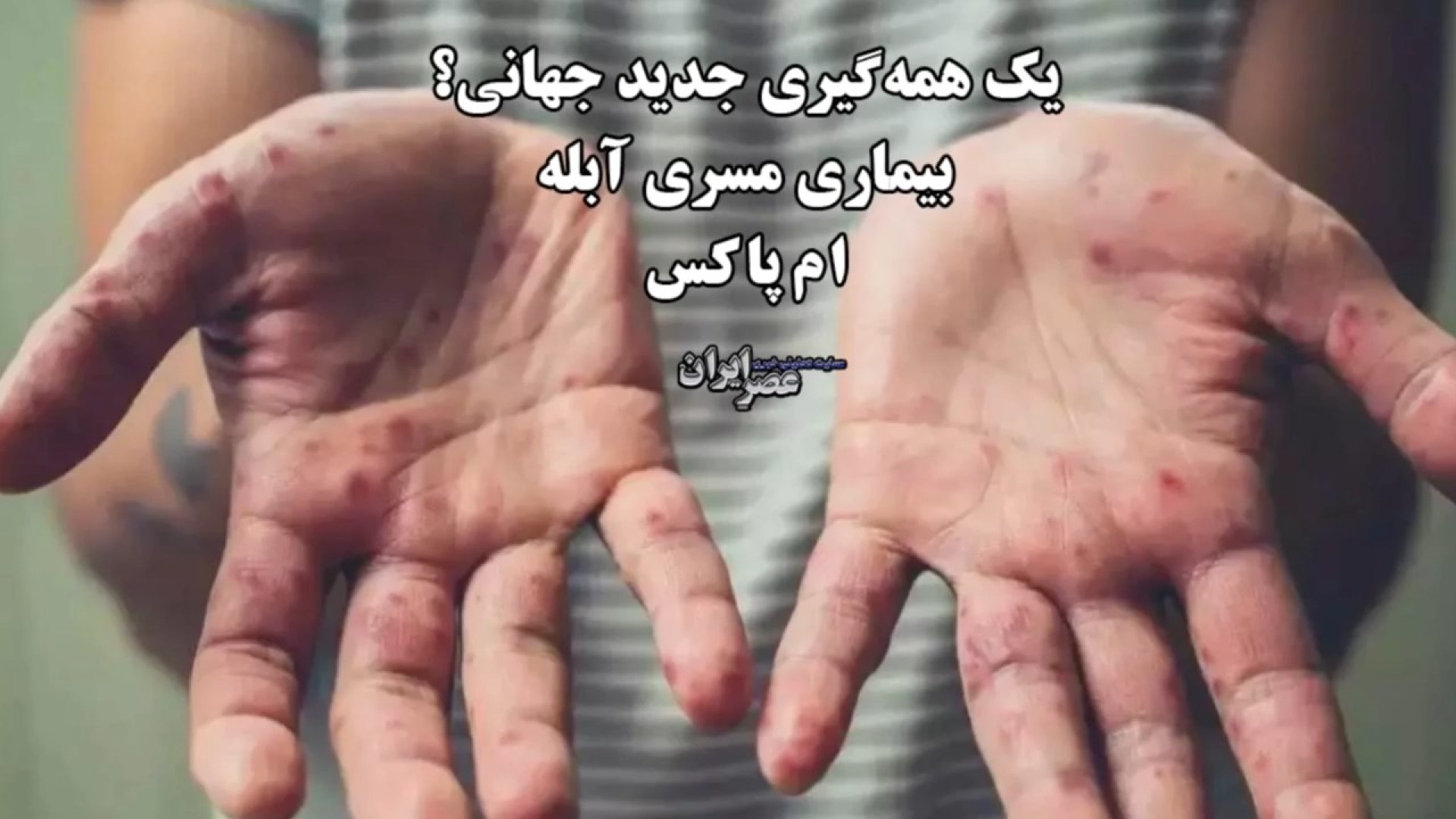یک همه&zwnj;گیری جدید جهانی در...
