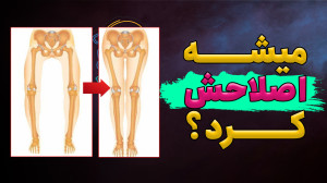 حرکات اصلاحی