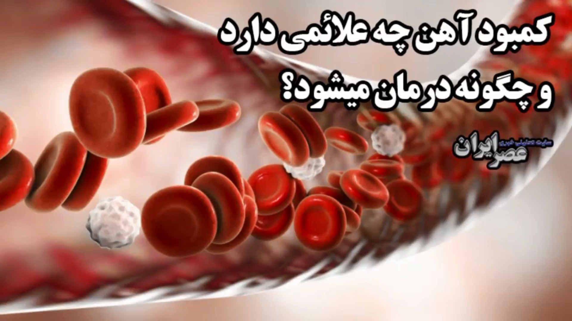 کمبود آهن چه علائمی دارد و چگو...