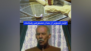 دندان مصنوعي رضا شاه