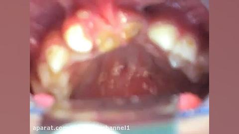 کیس پرزنت شکاف کام و لب