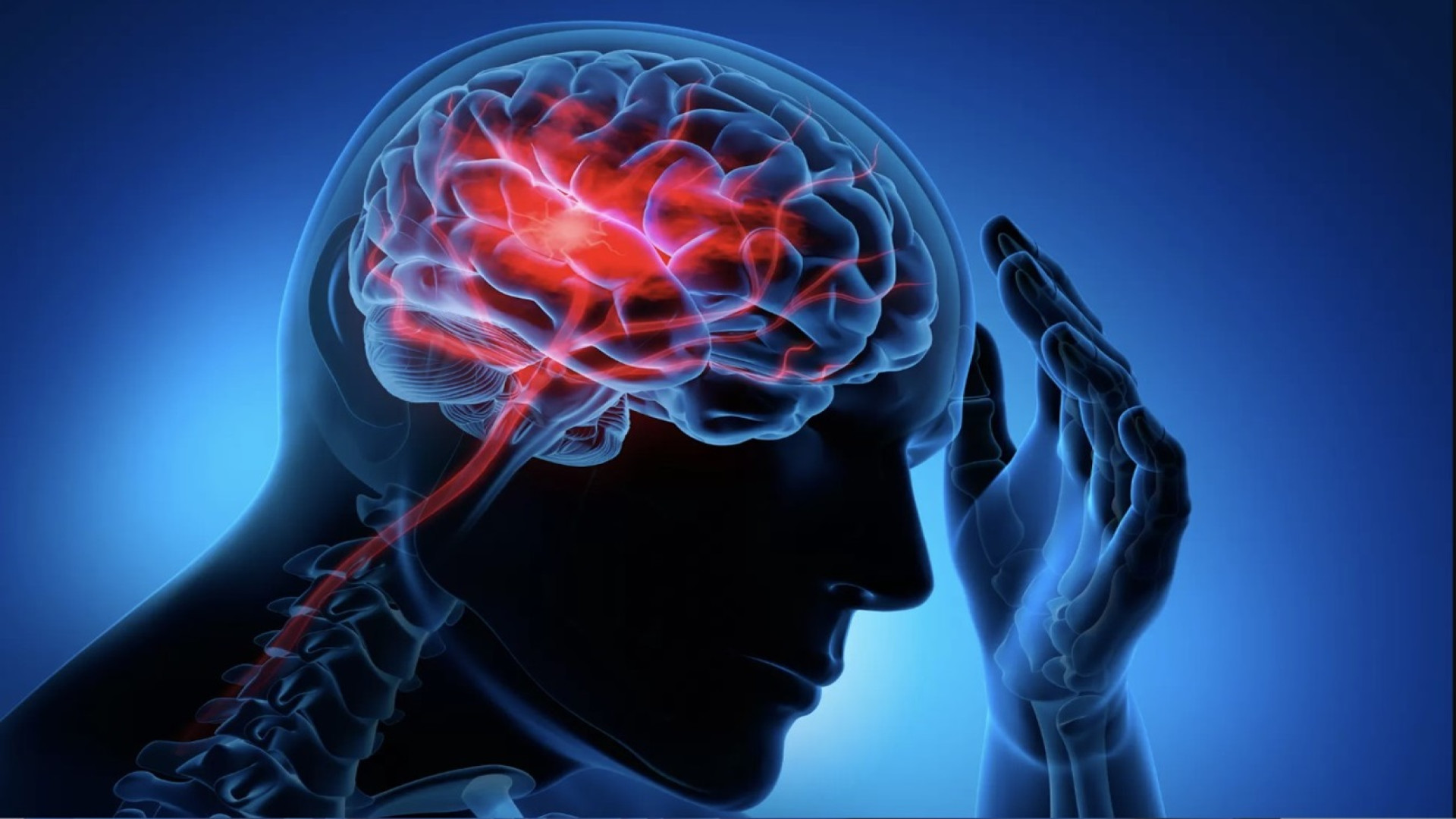 علائم سکته مغزی خاموش