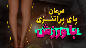همه چیز درباره پای پرانتزی و د...