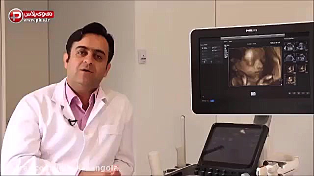 جوش آمدن آب دور جنین ,خطر سنوگ...