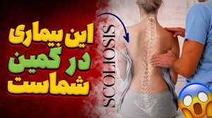 پیشگیری و اصلاح اسکلیوز یا انح...