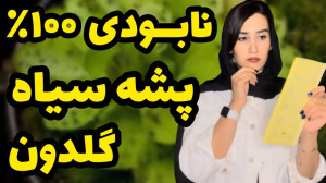 راه نابودی پشه سیاه گلدون چجور...