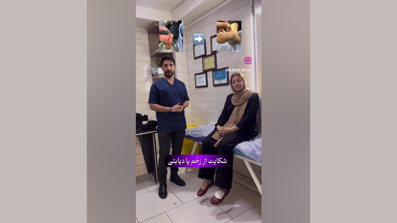ویدیو رضایت بیمار کلینیک زخم نیلمهر