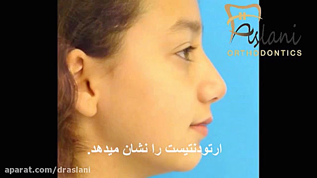 دندان نیش نهفته در ارتودنسی