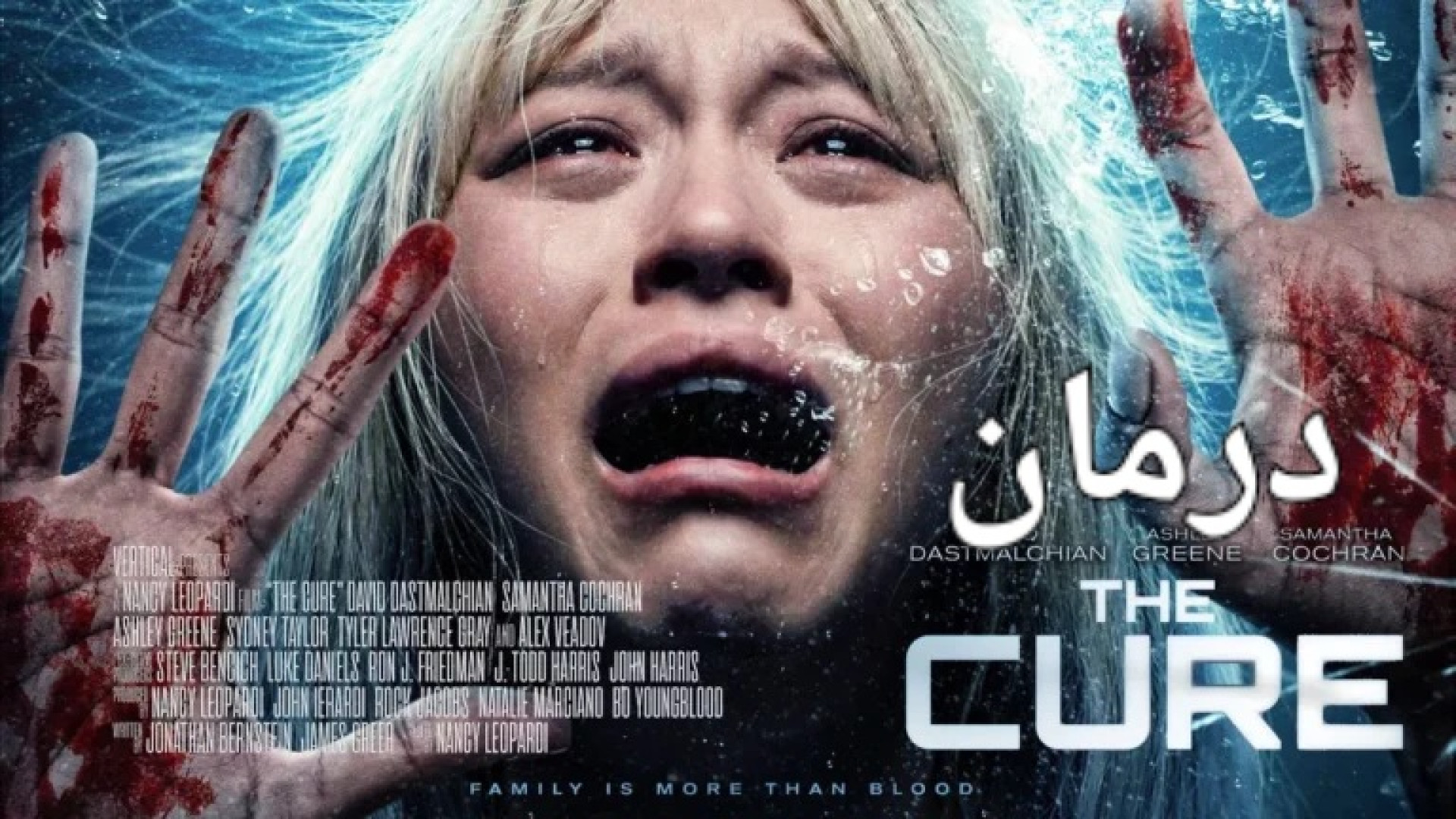 فیلم ترسناک و هیجانی درمان۲۰۲۶|The Cure|دوبله فارسی |لطفا فالو فراموش نشه️ زمان5377ثانیه