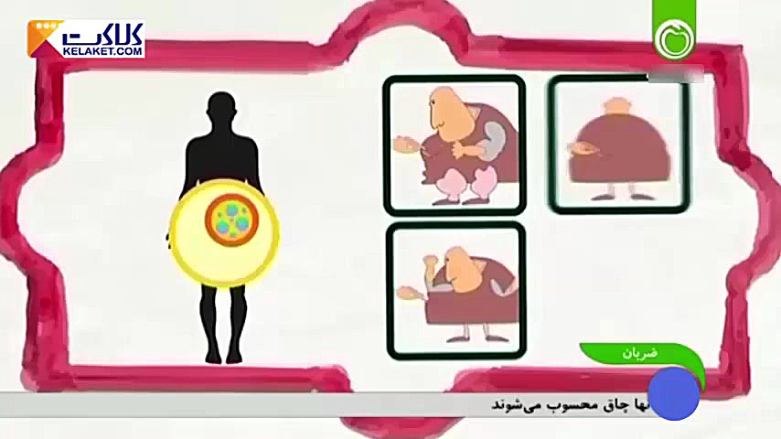 چاقی و جراحی زیبایی