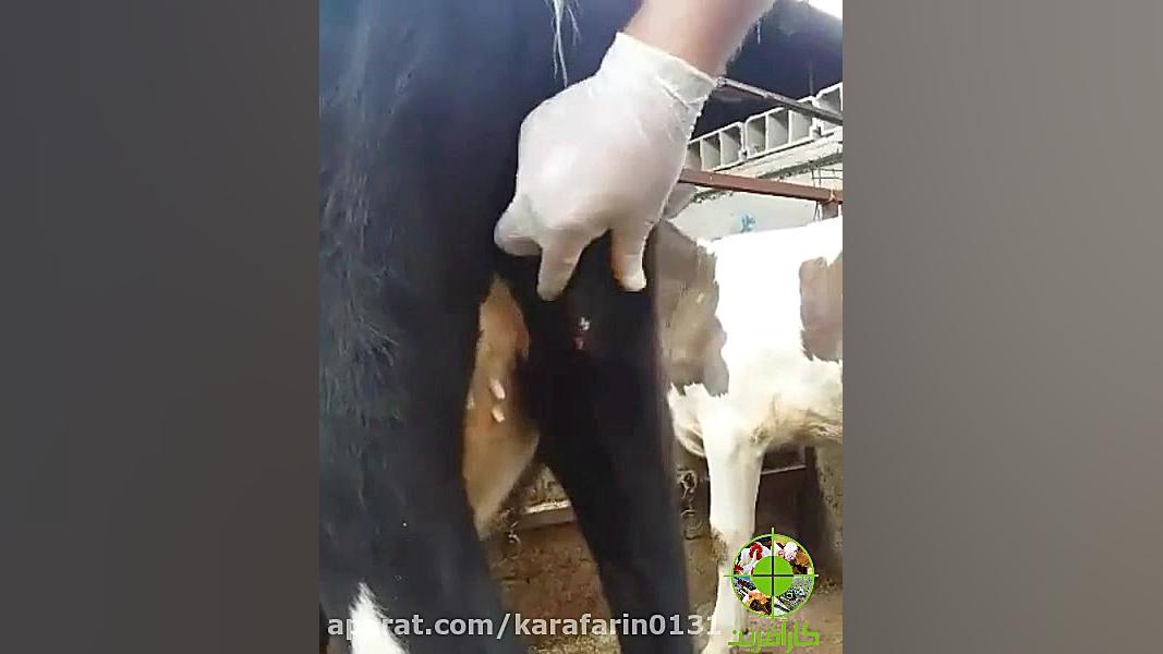 کلیپ آبسه ناشی از تزریقات در د...