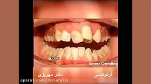 تغییرات حین درمان توسط متخصص ا...