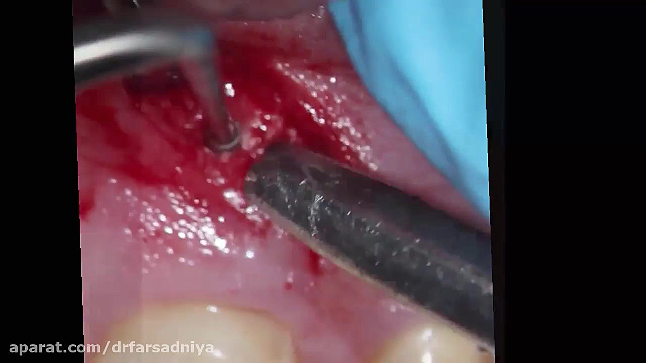 جراحی دندانپزشکی