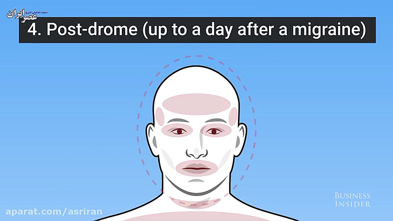 تفاوت بین میگرن و سردرد