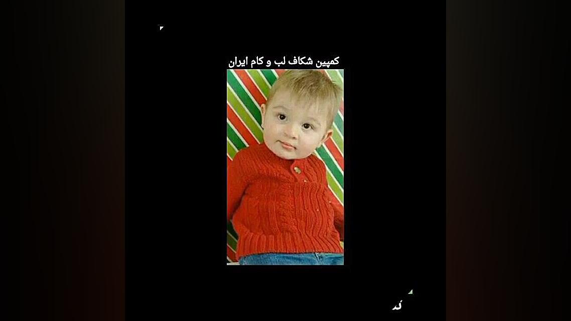 تاثیر مثبت کمپین شکاف لب و کام...