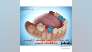 بهترین متخصص ارتودنسی
