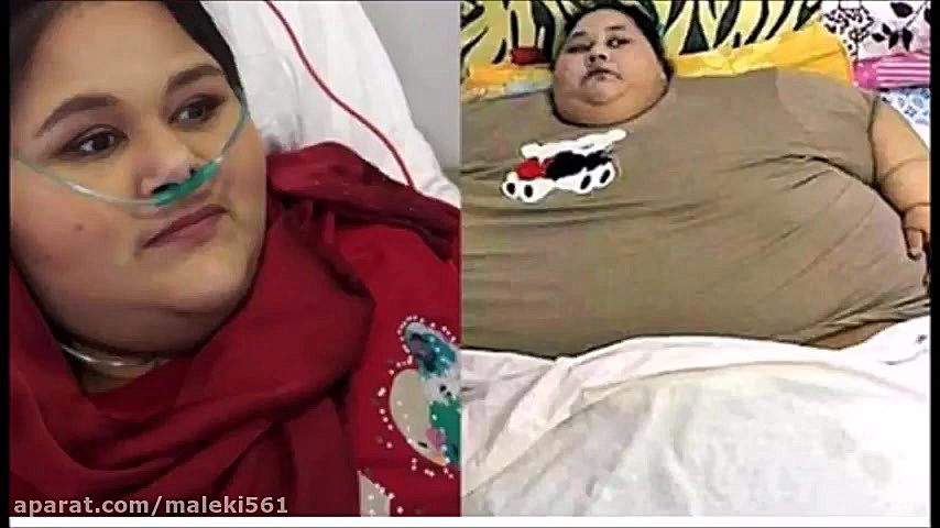 چاق ترین دختر جهان در آستانه ب...