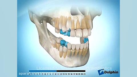 تکامل و رویش دندان های شیری و...