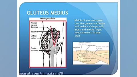 آموزش تزریقات آمپول