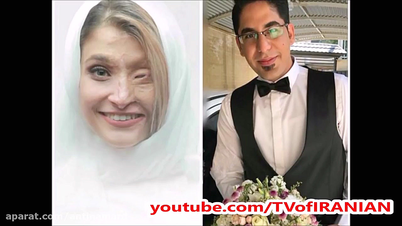 دختری که در اصفهان قربانی اسید...