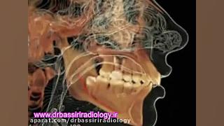 سی تی اسکن دندان