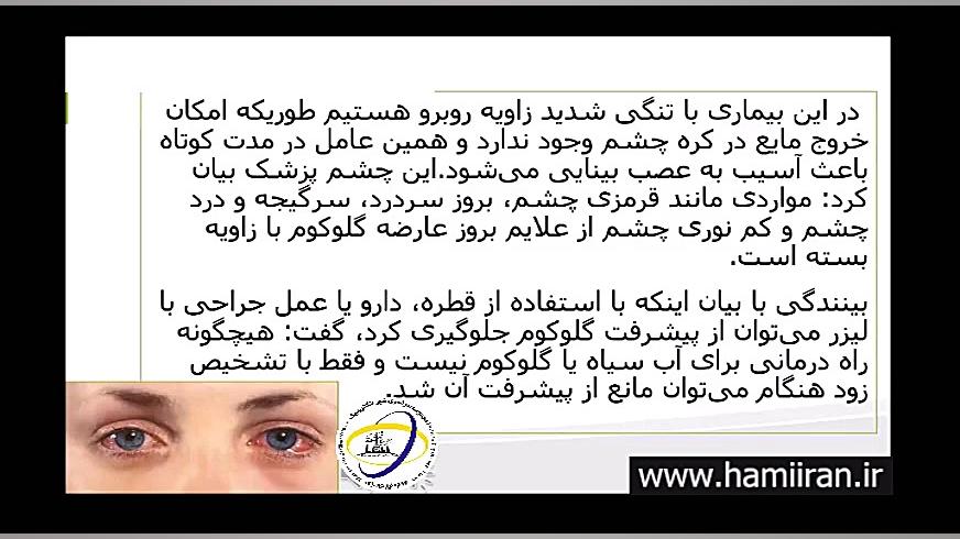 بیماری چشمی