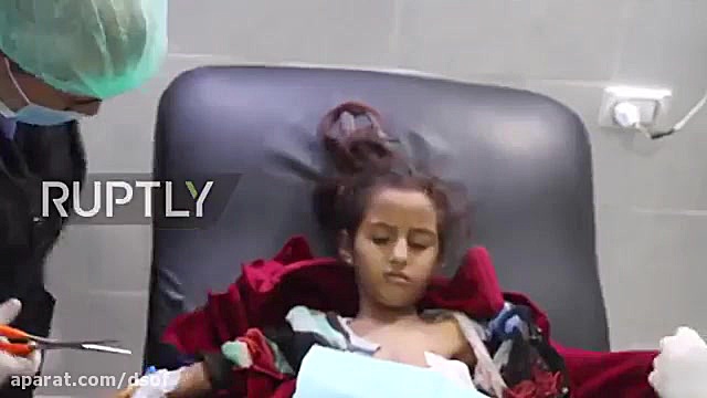 زخمی های حملات هوایی ارتش ترکی...