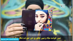 دختری که ریش و سیبیل دارد