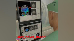 جراحی مغز با NeuroBlate