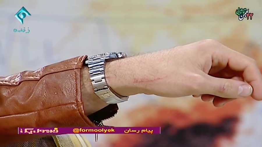 زخمی شدن علی ضیا در حاشیه برنا...