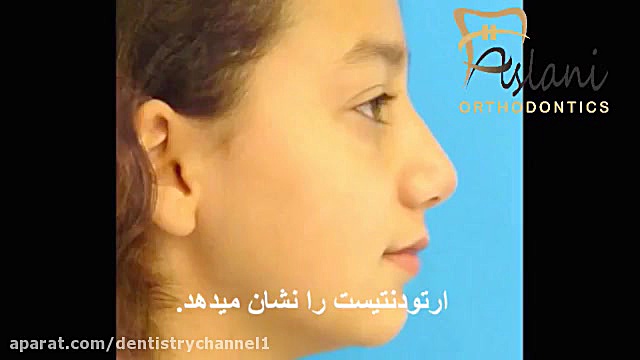 دندان نیش نهفته(دکتراصلانی)