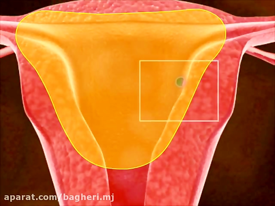پس از لقاح، جایگزینی و تشکیل پردههای آمنیون-زیست11