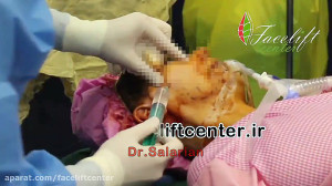 جراحی فیس لیفت در مرکز فیس لیف...